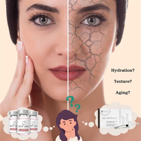 chanel injection vs profhilo|profhilo injection pattern.